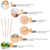 Rose Gold Pimple Extractor Beauty Kit